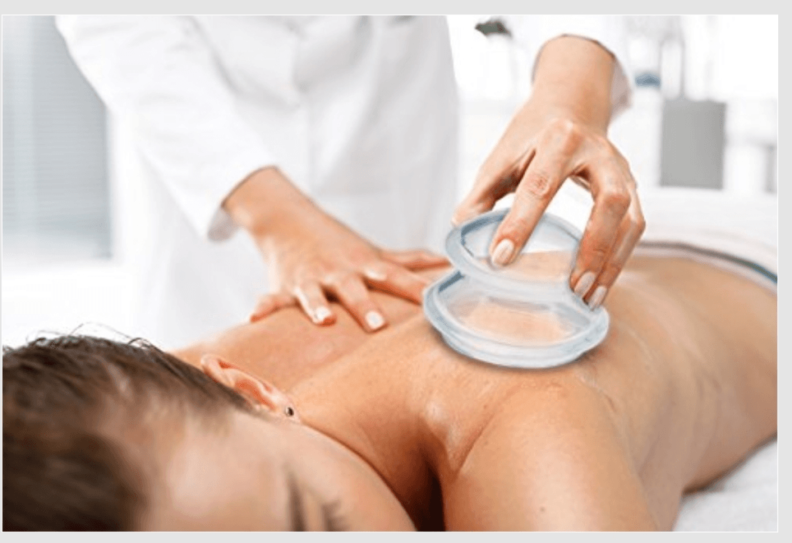 Image for Cupping Therapy & Massage